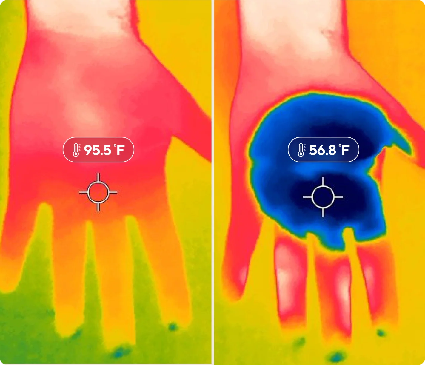 CryoTherm™ Palm - Image 7